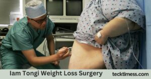 Iam Tongi Weight Loss Surgery